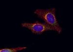 Galectin 8 Antibody in Immunocytochemistry (ICC/IF)