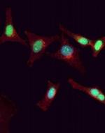 PDCD4 Antibody in Immunocytochemistry (ICC/IF)