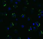 TRAIL-R2 (DR5) Antibody in Immunocytochemistry (ICC/IF)