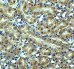 TRAIL-R2 (DR5) Antibody in Immunohistochemistry (Paraffin) (IHC (P))