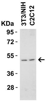 TRAIL-R2 (DR5) Antibody in Western Blot (WB)