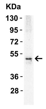 TRAIL-R2 (DR5) Antibody in Western Blot (WB)