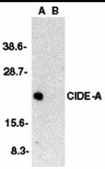 CIDEA Antibody in Western Blot (WB)