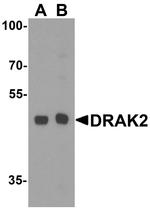 DRAK2 Antibody in Western Blot (WB)