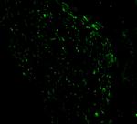 NOXA Antibody in Immunocytochemistry (ICC/IF)