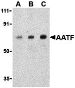 AATF Antibody in Western Blot (WB)