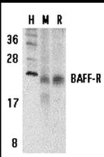 CD268 (BAFF Receptor) Antibody in Western Blot (WB)