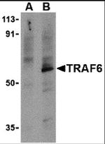 TRAF6 Antibody in Western Blot (WB)