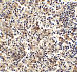 TLR4 Antibody in Immunohistochemistry (IHC)