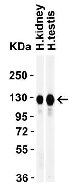 ACE2 Antibody in Western Blot (WB)