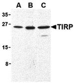 TICAM2 Antibody in Western Blot (WB)