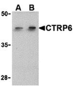 CTRP6 Antibody in Western Blot (WB)