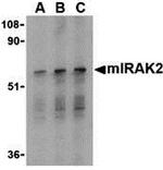 IRAK2 Antibody in Western Blot (WB)