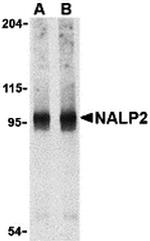 NALP2 Antibody in Western Blot (WB)