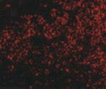 TNFRSF14 Antibody in Immunohistochemistry (IHC)