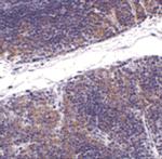 TNFRSF14 Antibody in Immunohistochemistry (IHC)