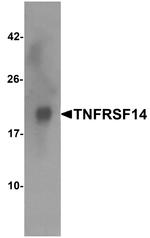 TNFRSF14 Antibody in Western Blot (WB)