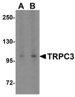 TRPC3 Antibody in Western Blot (WB)