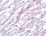 UNG Antibody in Immunohistochemistry (Paraffin) (IHC (P))