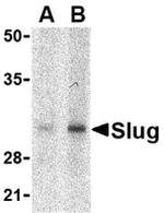 SLUG Antibody in Western Blot (WB)