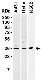 CD254 (RANK Ligand) Antibody in Western Blot (WB)