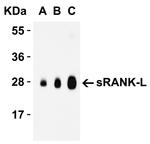 CD254 (RANK Ligand) Antibody in Western Blot (WB)