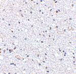 TSLP Antibody in Immunohistochemistry (Paraffin) (IHC (P))