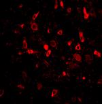 TSLP Antibody in Immunohistochemistry (PFA fixed) (IHC (PFA))