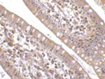 CIDEB Antibody in Immunohistochemistry (IHC)