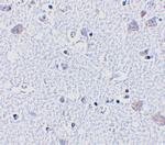 BRSK1 Antibody in Immunohistochemistry (IHC)