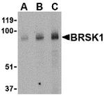 BRSK1 Antibody in Western Blot (WB)