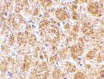 DARC Antibody in Immunohistochemistry (IHC)