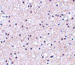 IEX-1 Antibody in Immunohistochemistry (IHC)