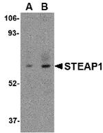 STEAP1 Antibody in Western Blot (WB)