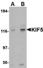 Kinesin 5A Antibody in Western Blot (WB)