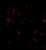 DISC1 Antibody in Immunocytochemistry (ICC/IF)