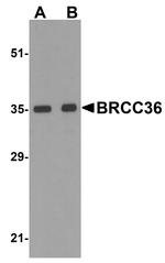 BRCC3 Antibody in Western Blot (WB)