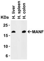 ARMET Antibody in Western Blot (WB)