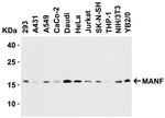 ARMET Antibody in Western Blot (WB)