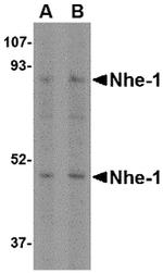 Nhe-1 Antibody in Western Blot (WB)