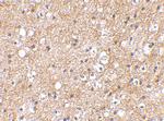 SP110 Antibody in Immunohistochemistry (IHC)