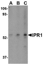 SP110 Antibody in Western Blot (WB)