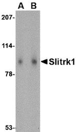 SLITRK1 Antibody in Western Blot (WB)