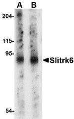 SLITRK6 Antibody in Western Blot (WB)