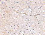 FBXL20 Antibody in Immunohistochemistry (IHC)