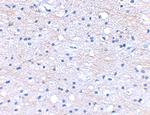 HAPLN2 Antibody in Immunohistochemistry (IHC)