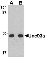 UNC93A Antibody in Western Blot (WB)