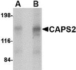 CADPS2 Antibody in Western Blot (WB)