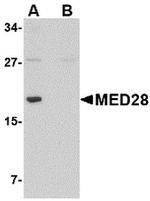 MED28 Antibody in Western Blot (WB)
