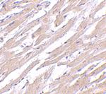 POFUT1 Antibody in Immunohistochemistry (IHC)